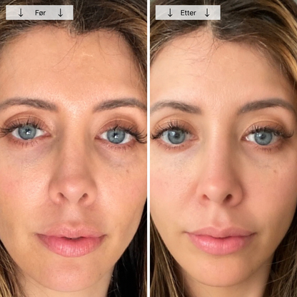 Beautyform® Nordglow Contour