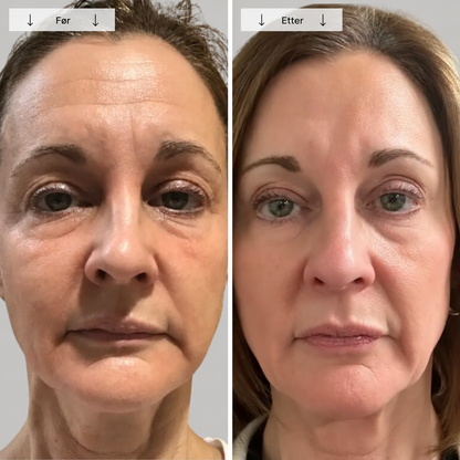 Beautyform® Nordglow Contour