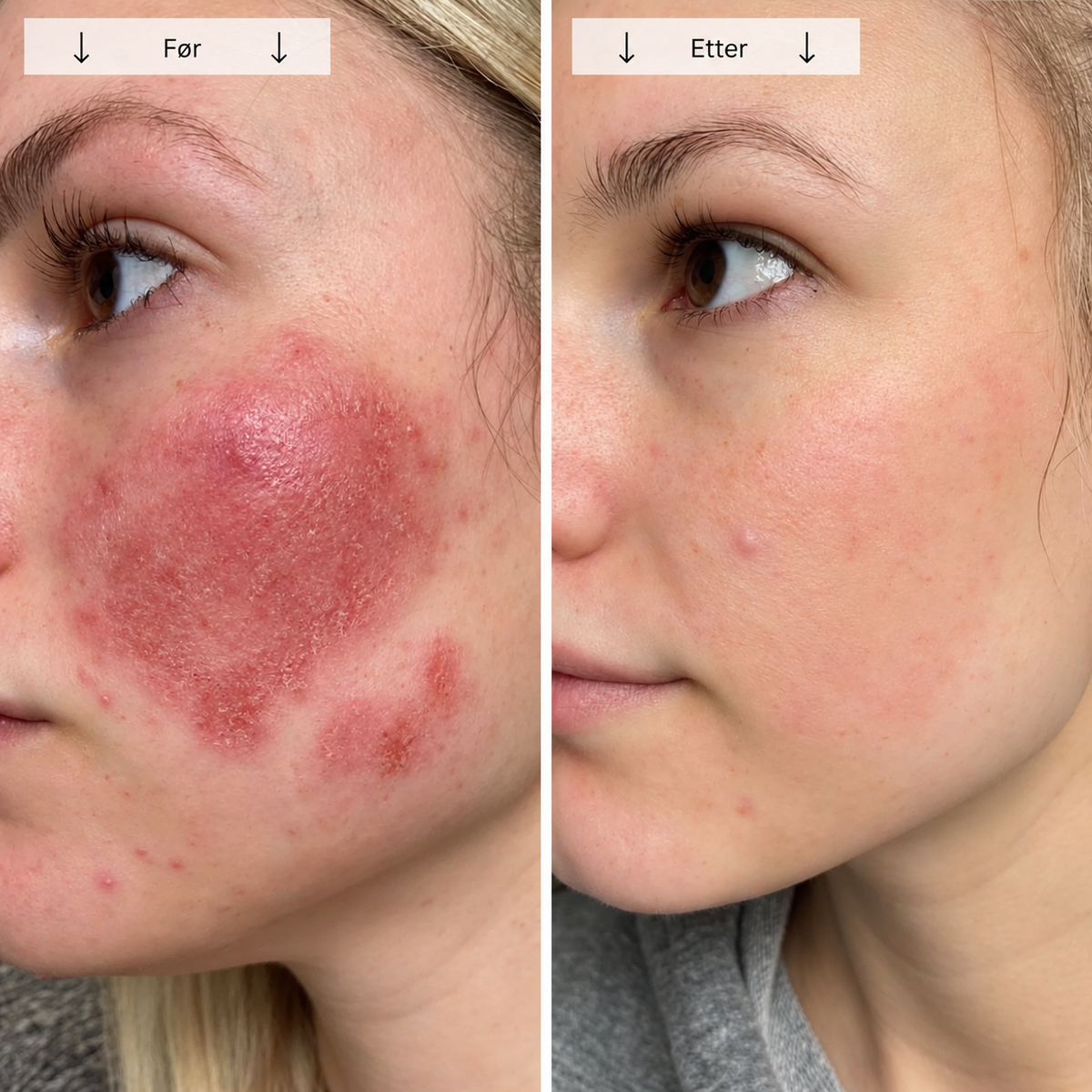 Beautyform® Nordglow Contour